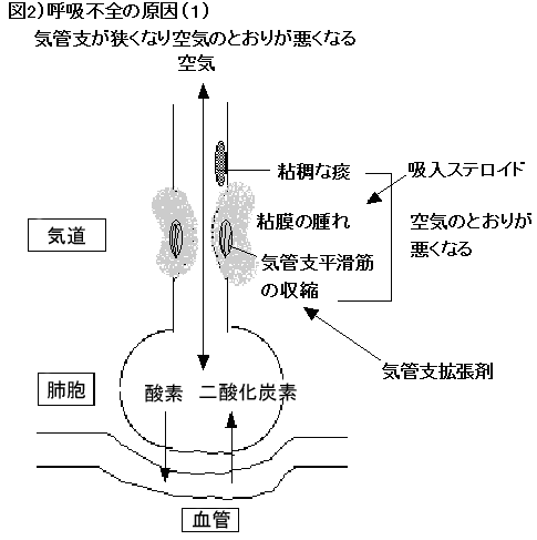 図2) 呼吸不全の原因(1)