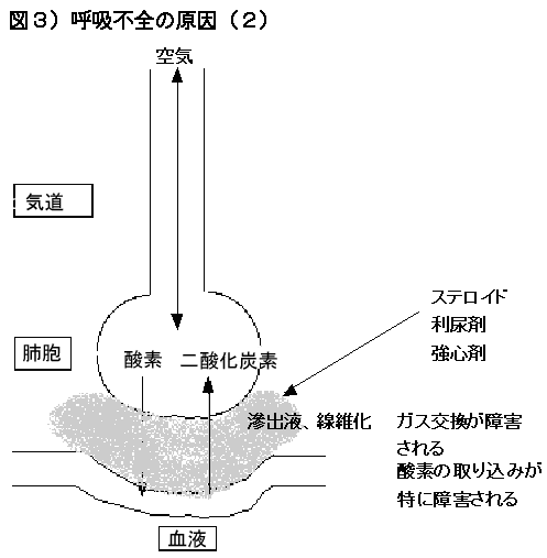 図3) 呼吸不全の原因(2)